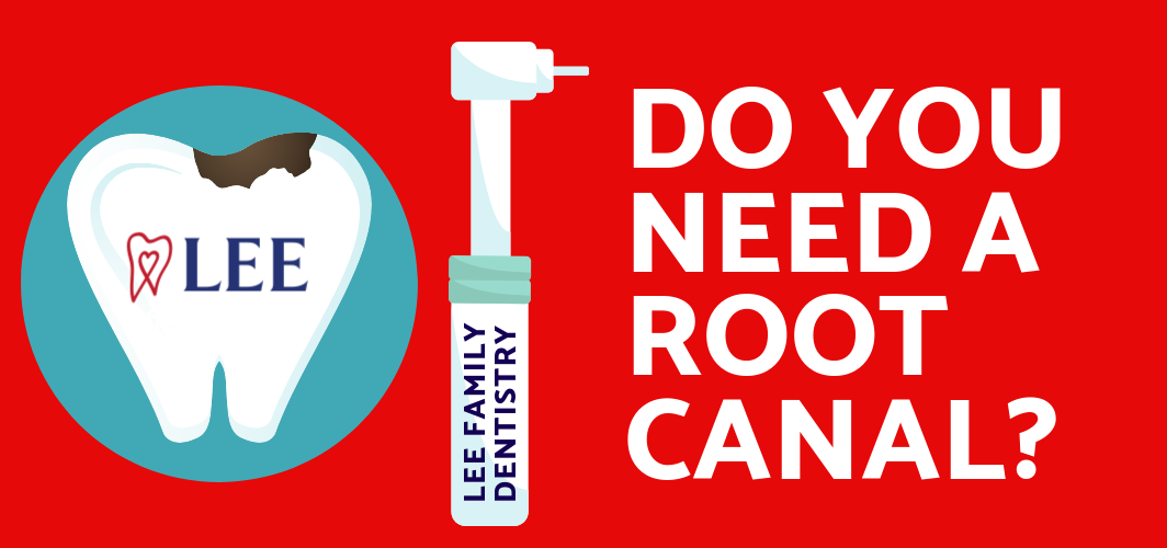 Do I Need A Root Canal?   Lee Family Dentistry