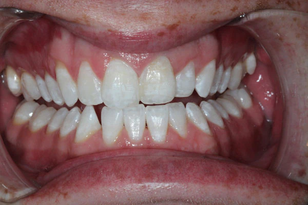 After image