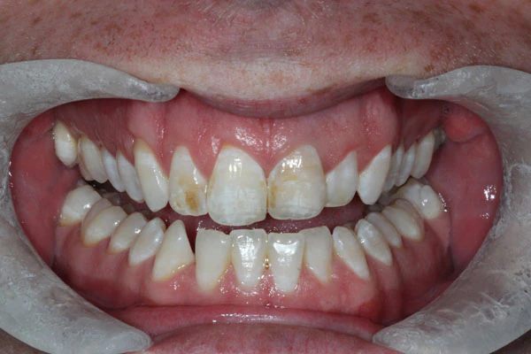 Before image