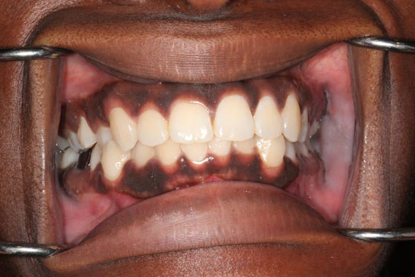 Before image