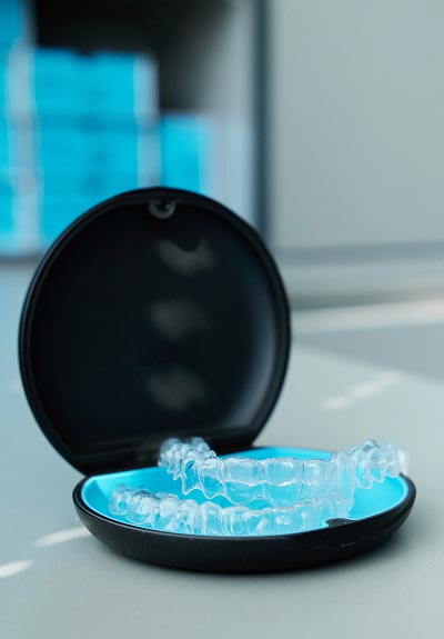 Smilers clear aligners Oxford, MS