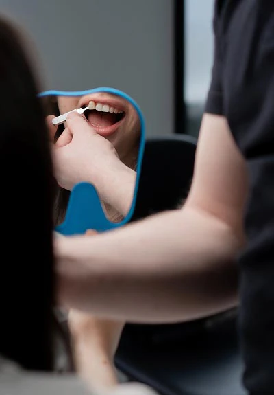 dental veneers Oxford, MS