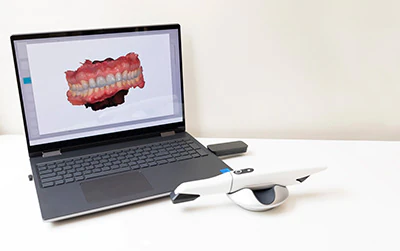 intraoral cameras used at Lee Dentistry