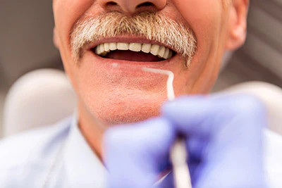 closeup of patient's restored smile at Lee Dentistry