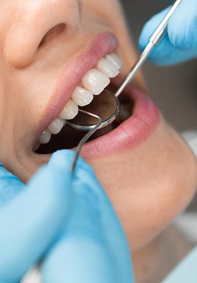 preventive dentistry Oxford, MS