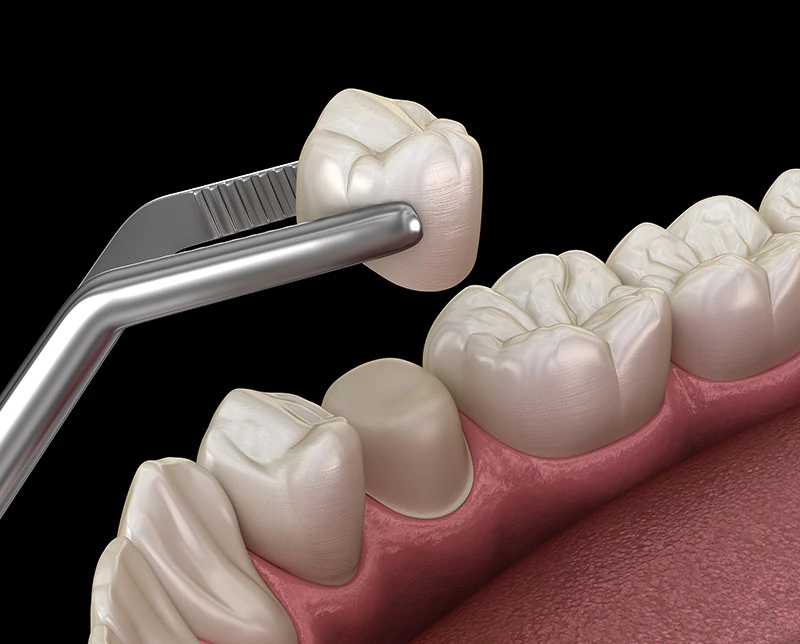 restorative dentistry Oxford, MS