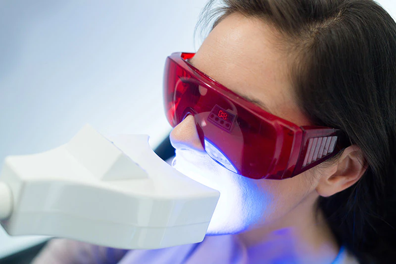 teeth whitening Oxford, MS