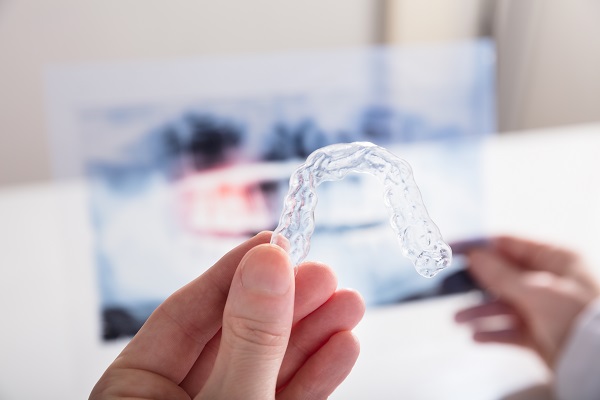 clear aligners Oxford, MS