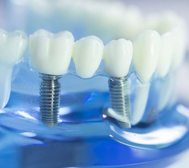Oxford Dental Implants