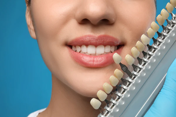 Dental Veneers Oxford, MS