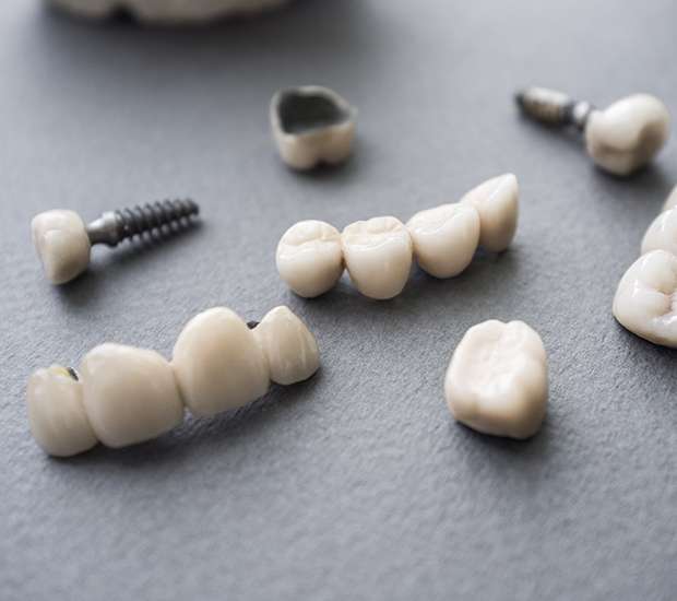 Oxford The Difference Between Dental Implants and Mini Dental Implants