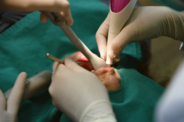 When Is Oral Surgery Necessary? Common Procedures Explained