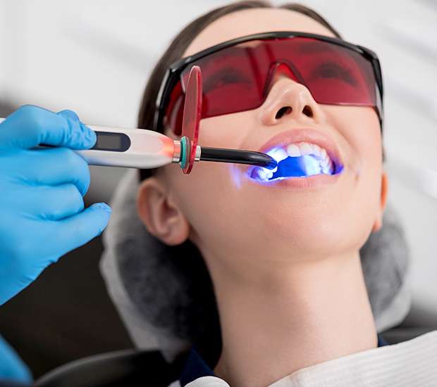 Oxford Professional Teeth Whitening
